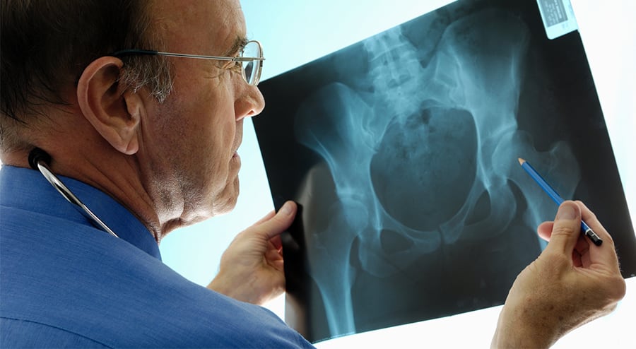 Doctor examining hip X-rays